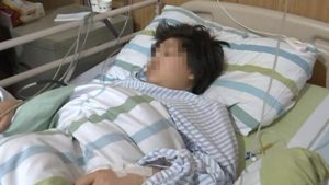 Dokter Temukan Gumpalan Rambut Raksasa dalam Perut Gadis 12 tahun