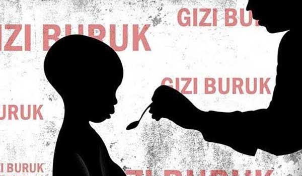 stunting gisi buruk