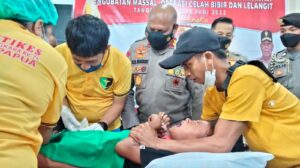 Khitanan Massal Polda Papua Diikuti 116 Anak, Operasi Bibir Sumbing 5 Orang