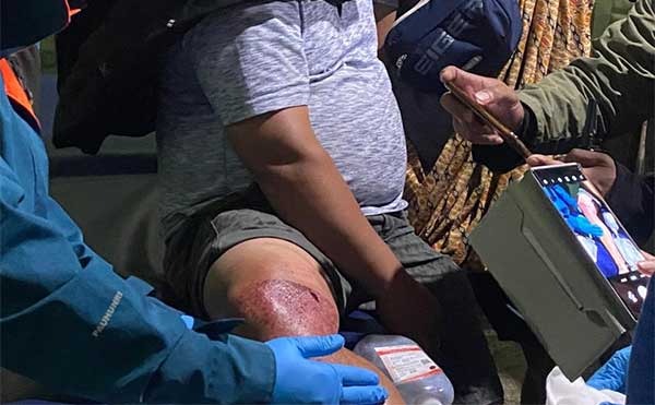 Penembakan Warga Sipil Kembali Terjadi di Puncak, Polisi Kejar Pelaku 1 IMG 20230902 WA0012