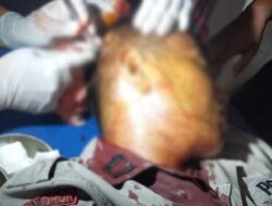 Satu Polisi di Keerom Alami Luka Serius Usai Dibacok, Begini Pemicu Awalnya