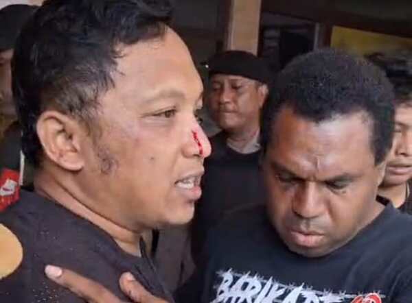 Aksi Damai di Bandara Sentani, Satu Pendemo Alami Kekerasan Fisik 2 IMG 20250812 WA00362